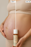 Bio Mama Olie 125ml – natuurlijke anti-striae olie voor zwangere vrouwen